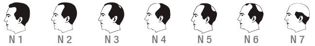 Escala de Norwood de Alopecia